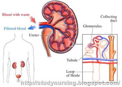 Nephrocity Nephrotic Syndrome | studynursing